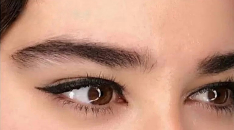 Endoscopic Eyebrow And Temple Lift Operation
