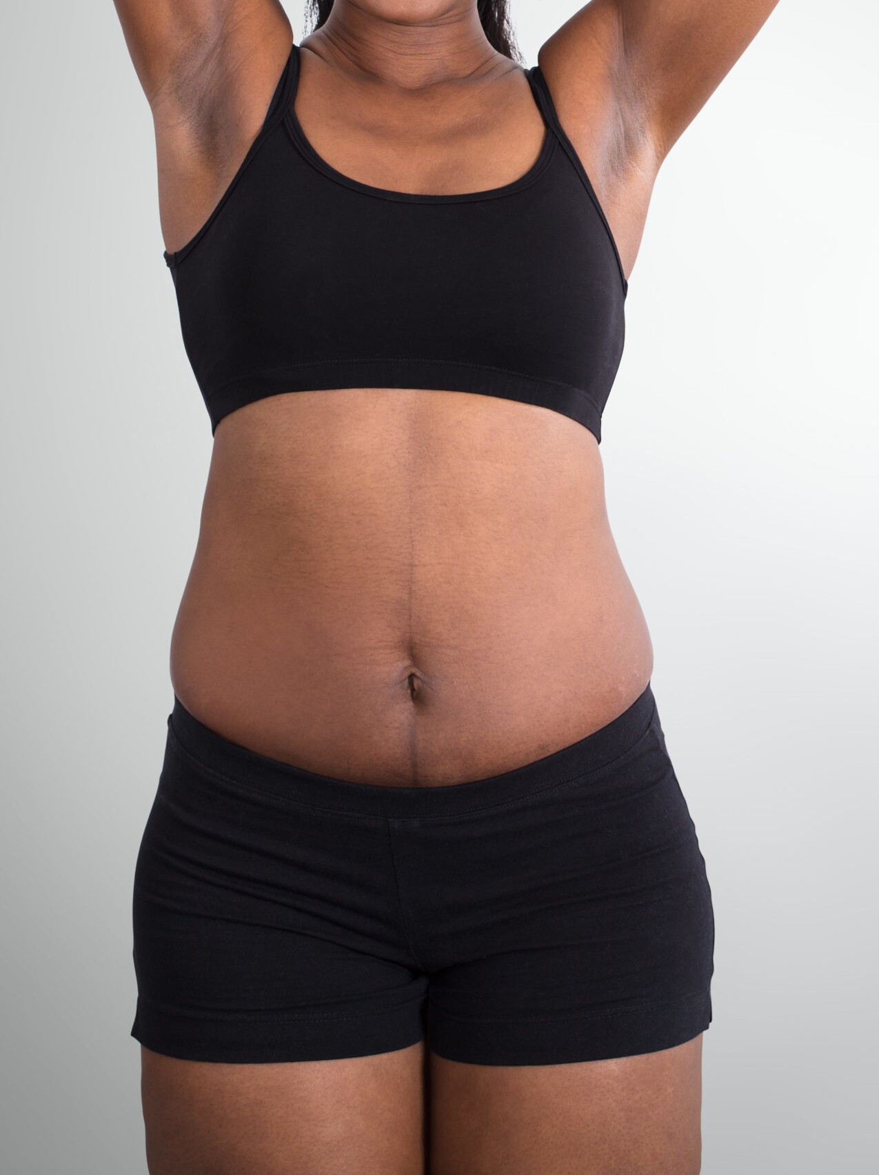 Body Contouring