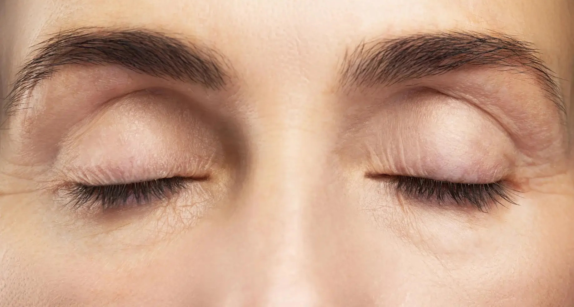 Facial Botox Injections