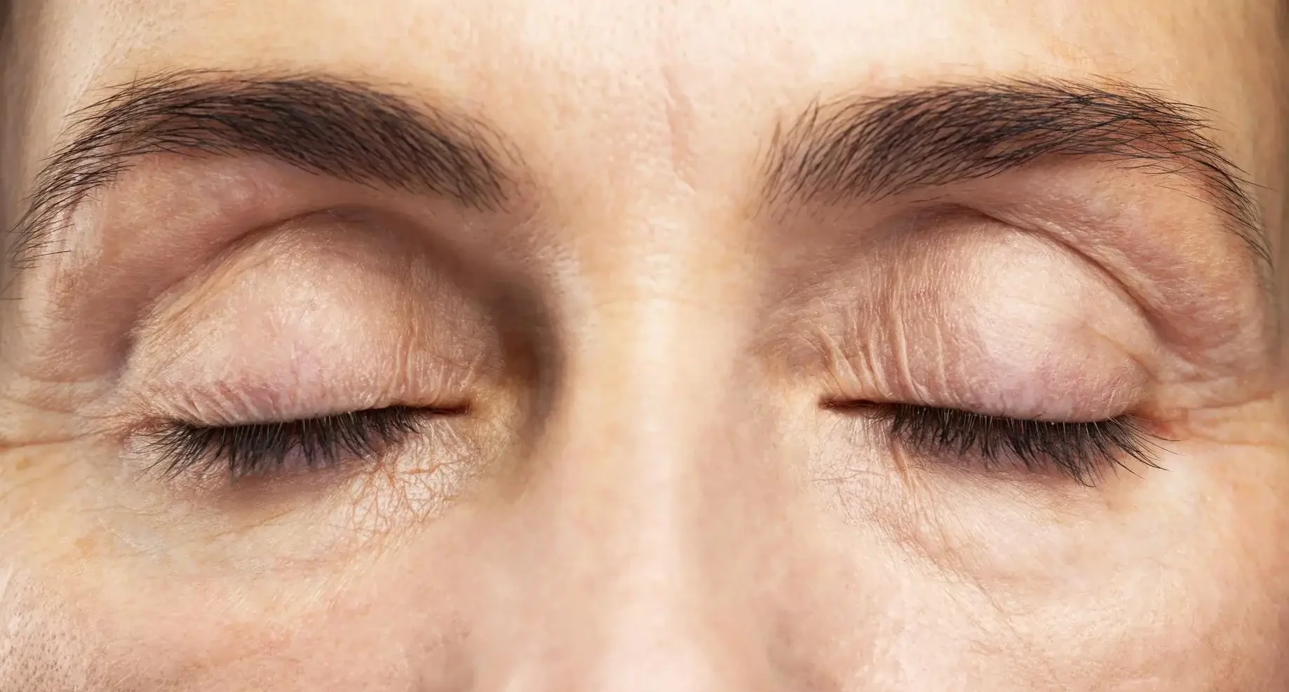 Facial Botox Injections