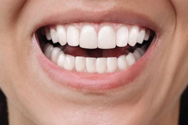 Dental