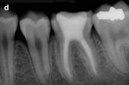 Endodontics