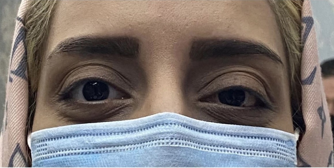Eye Deflection Surgery