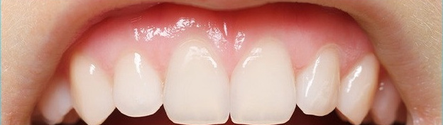 Pediatric Dentistry