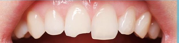 Pediatric Dentistry