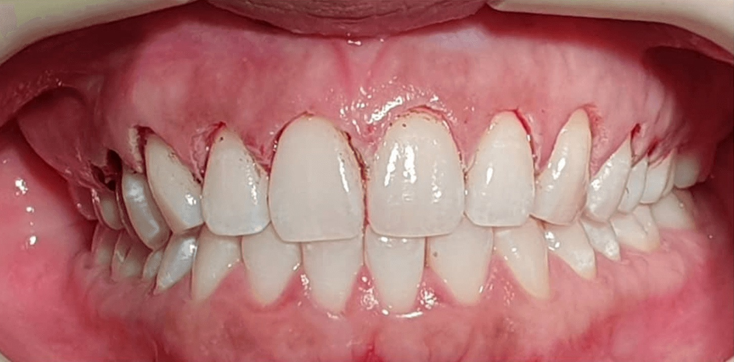 Periodontics