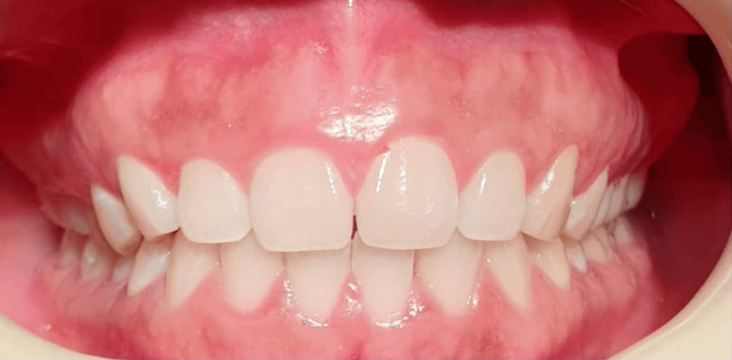 Periodontics