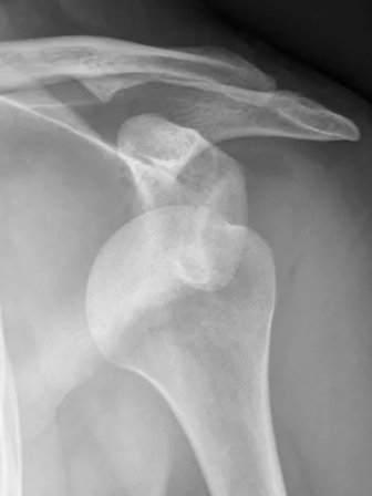 Orthopedic Surgery for Sports Injuries