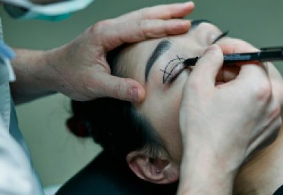 blepharoplasty-scaled2 blepharoplasty-scaled2