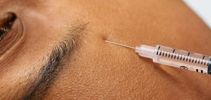 facial botox-top