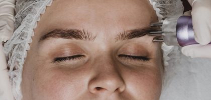 facial carboxytherapy-top