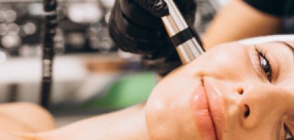facial mesotherapy-top