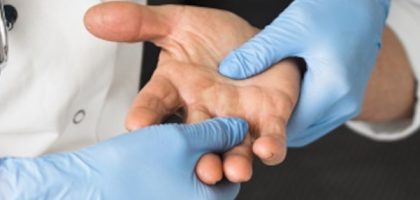 hand surgery-top