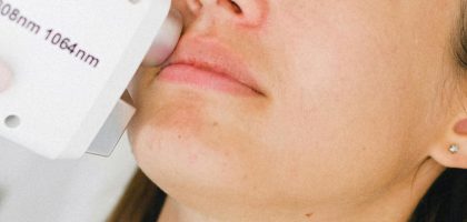 hifu facial1-top