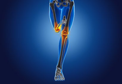 knee replacement-scaled knee replacement-scaled