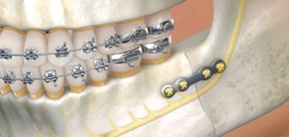 oral-maxillofacial-top