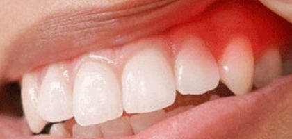 periodontist-top