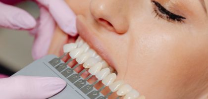 restorative and cosmetic-top